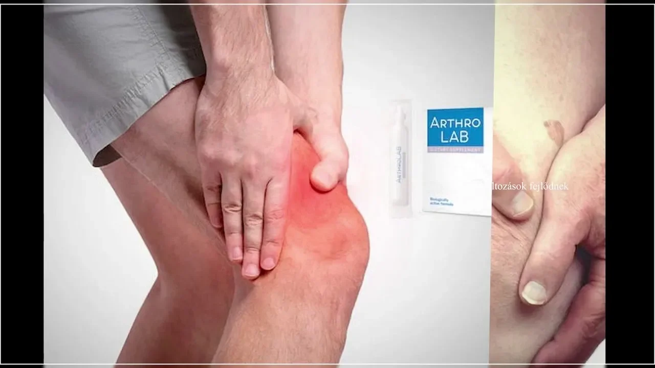 Jointflex : Türkiye'de eczaneden nereden alınır?